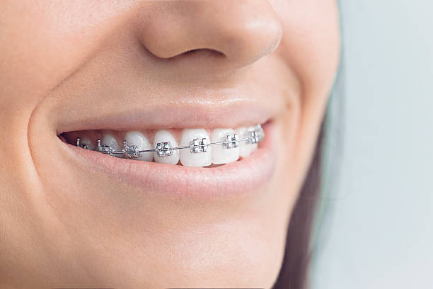 Best Sedation Dentistry  in Purvis, MS